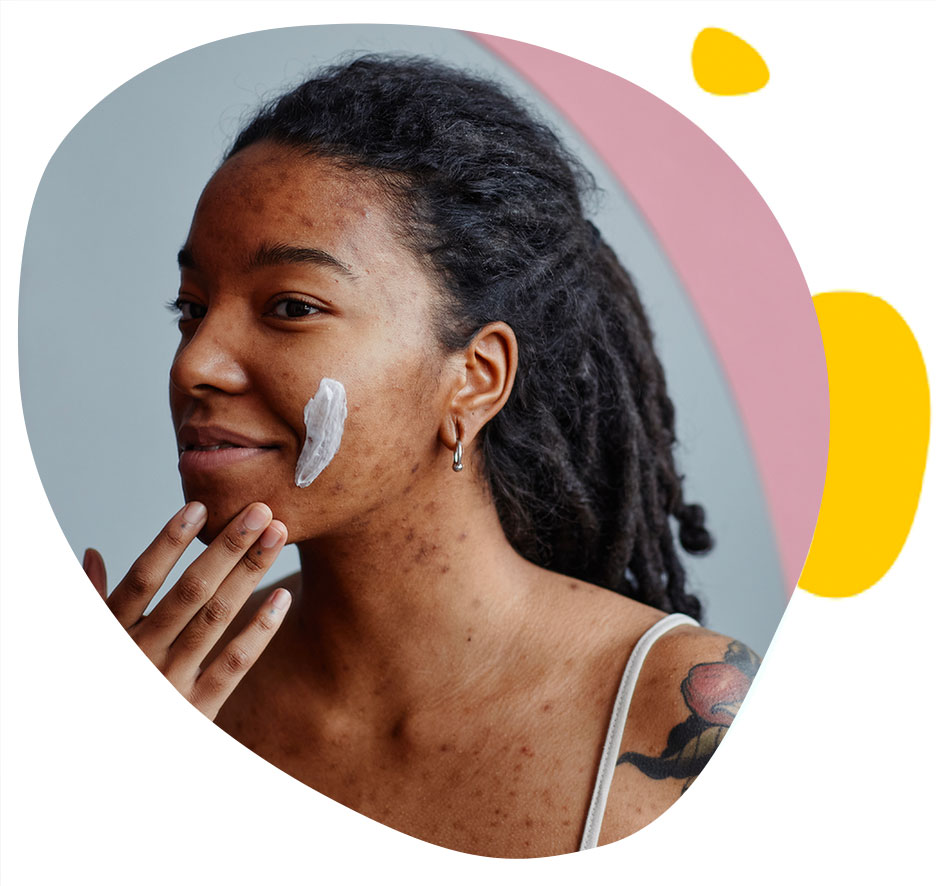 Jeune femme avec de l'acné applique un soin du visage