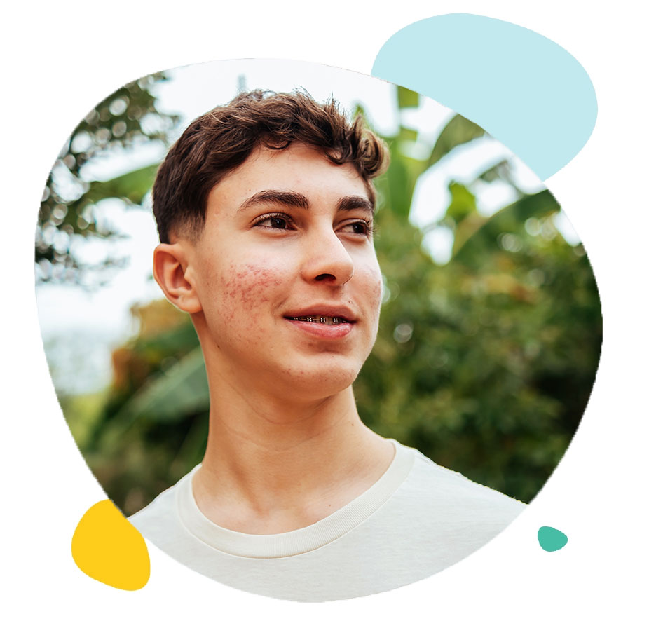 Adolescent souriant avec de l'acné et un appareil dentaire