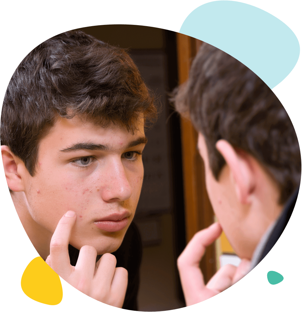 Un jeune homme regarde ses boutons dans le miroir Un jeune homme regarde ses boutons dans le miroir