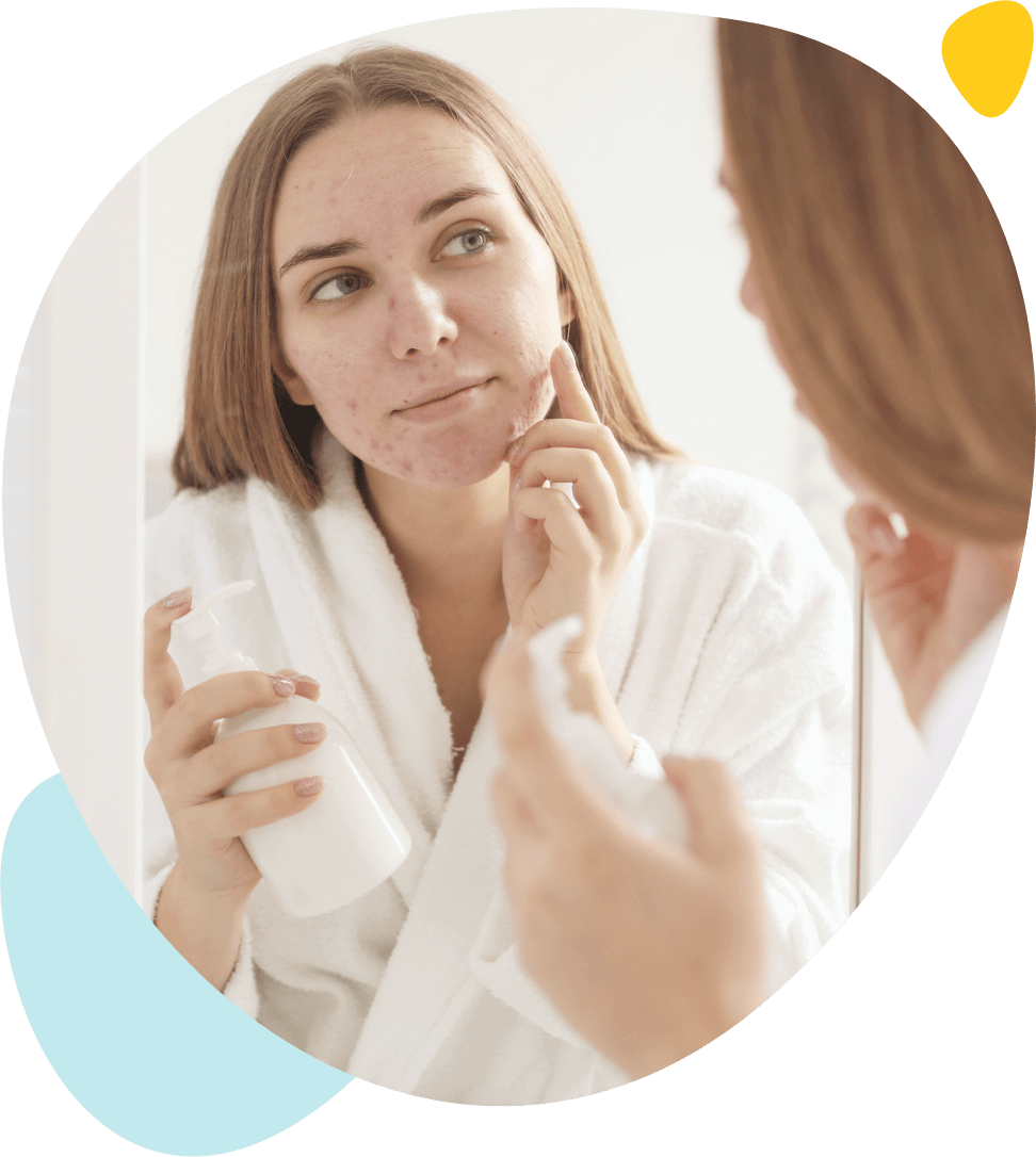 Une jeune atteinte d'acné sévère se met se démaquille devant la glace